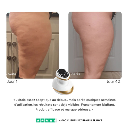 BodySculpt™ Appareil anti-cellulite chauffant à aspiration